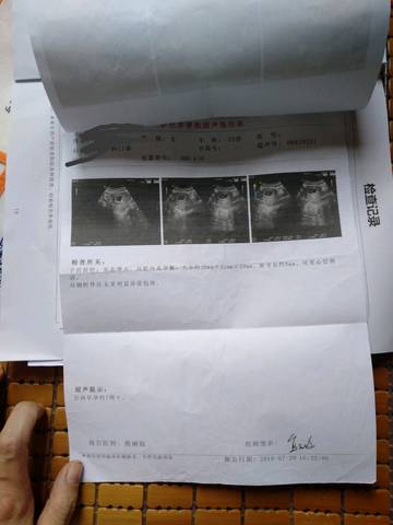 journal_insert_pic_1117997501