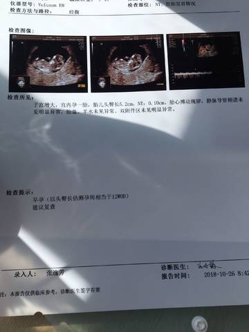 journal_insert_pic_1118652090
