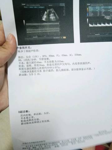 journal_insert_pic_1119778839