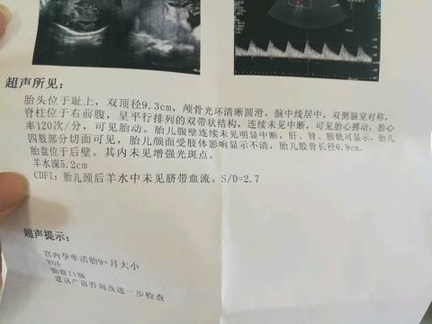 journal_insert_pic_1120419042