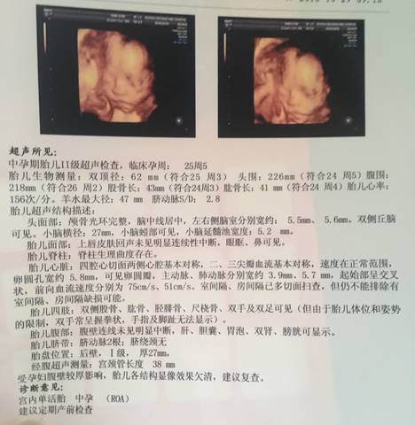 journal_insert_pic_1120553468
