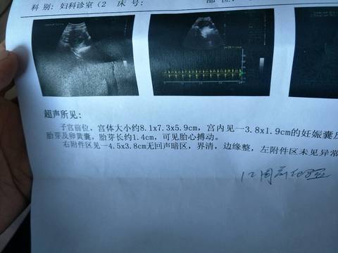 journal_insert_pic_1120506209
