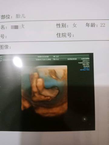 journal_insert_pic_1121169070