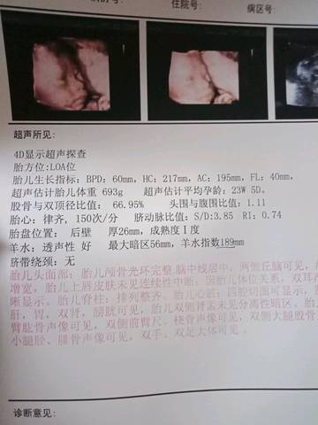 journal_insert_pic_1120953152