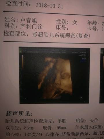 journal_insert_pic_1122248965