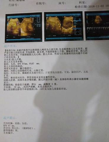 journal_insert_pic_1122616369