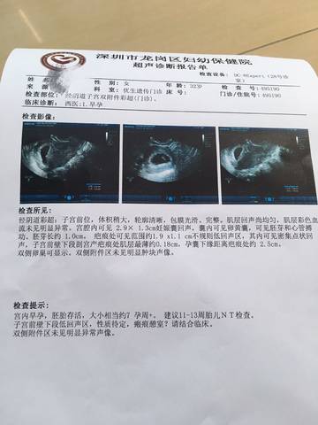 journal_insert_pic_1123042419