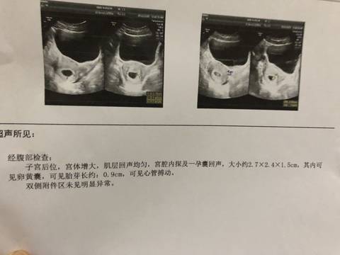 journal_insert_pic_1124597058