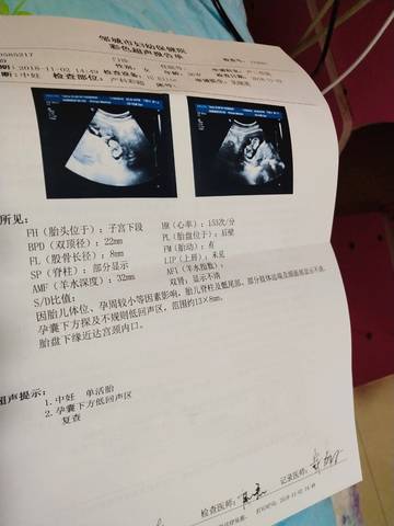 journal_insert_pic_1124323269