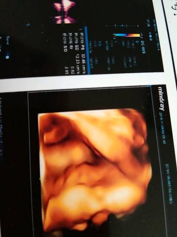 journal_insert_pic_1125546323
