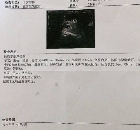 journal_insert_pic_1125892264