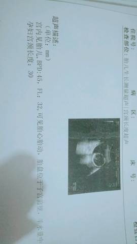 journal_insert_pic_1126029974
