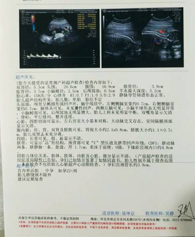 journal_insert_pic_1126963423