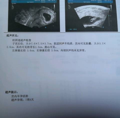 journal_insert_pic_1127212095