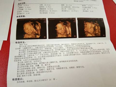 journal_insert_pic_1129090726