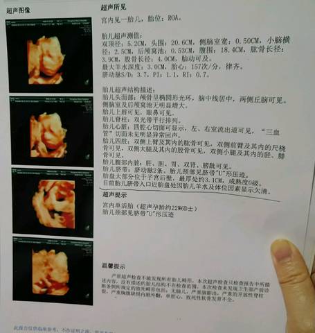 journal_insert_pic_1130414210