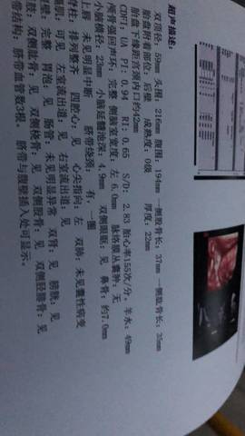 journal_insert_pic_1132993220