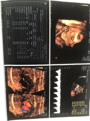 journal_insert_pic_1134456222