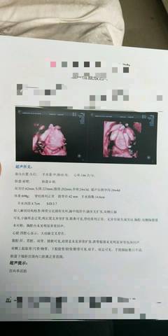 journal_insert_pic_1135202045