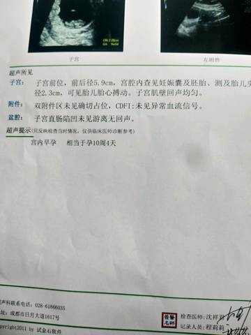 journal_insert_pic_1135697489
