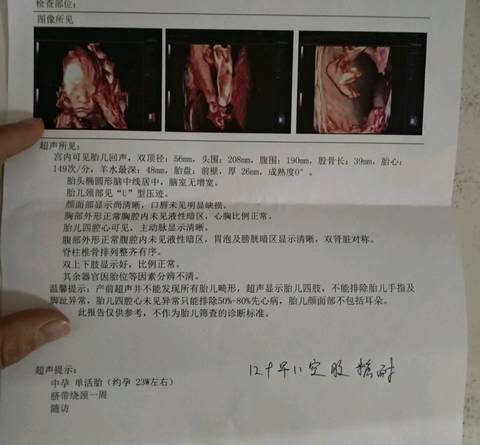 journal_insert_pic_1136290642