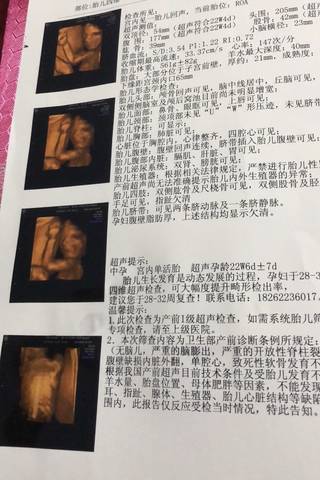 journal_insert_pic_1138075081