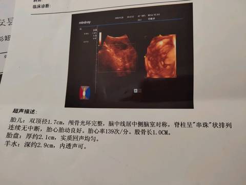 journal_insert_pic_1138848478
