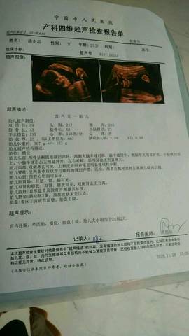 journal_insert_pic_1138995558