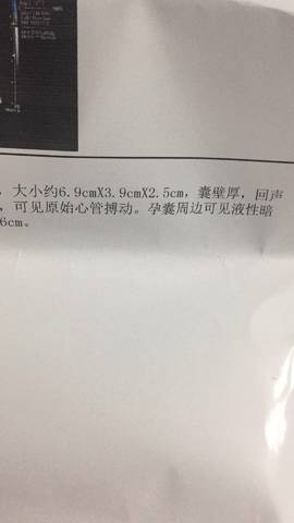 journal_insert_pic_1139749551
