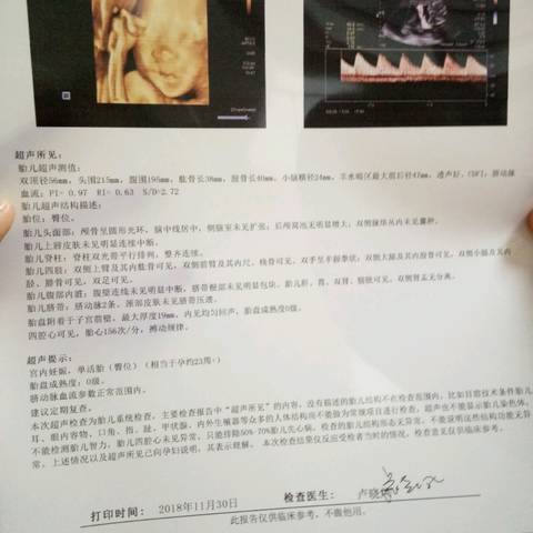 journal_insert_pic_1140507830