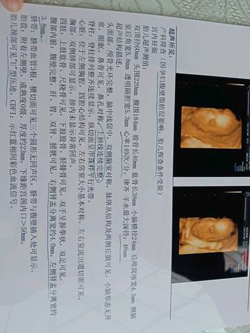 journal_insert_pic_1140368658