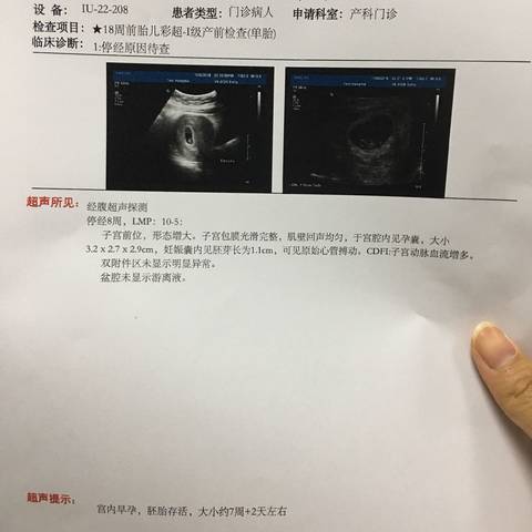 journal_insert_pic_1140763135