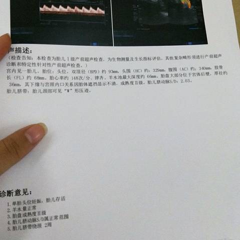 journal_insert_pic_1140521090