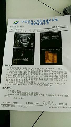 journal_insert_pic_1140485570