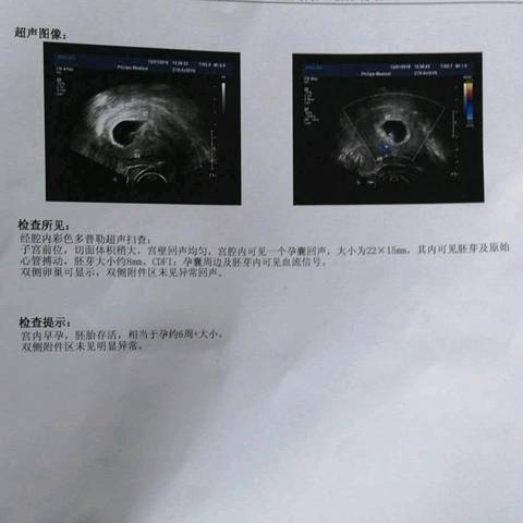 journal_insert_pic_1141700854
