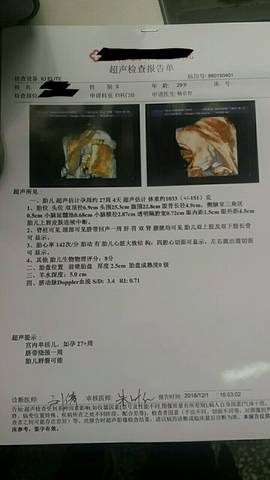 journal_insert_pic_1141572189