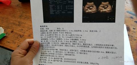 journal_insert_pic_1142643268