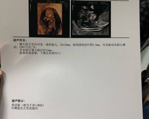 journal_insert_pic_1142533053