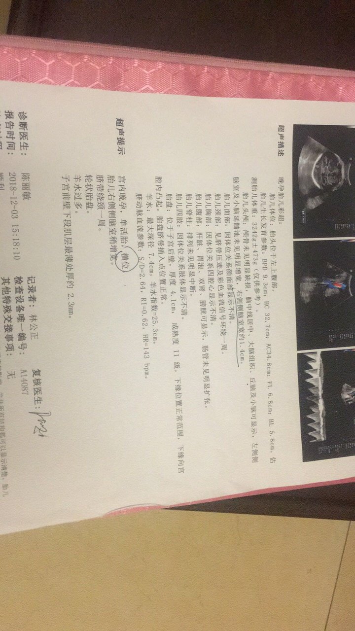 36周了，检查右脑增宽1.4cm