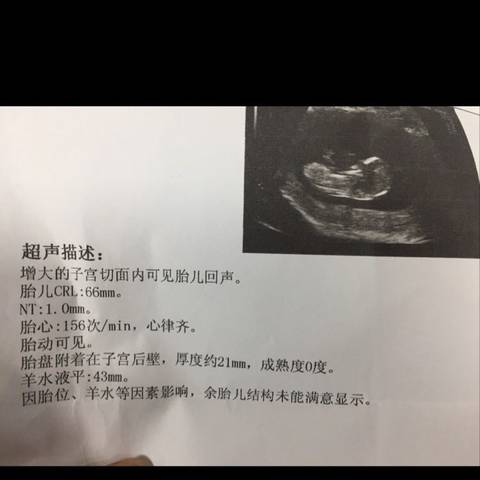 journal_insert_pic_1146148102