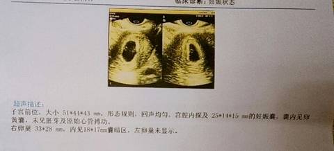 journal_insert_pic_1146768612