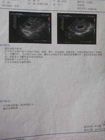 journal_insert_pic_1146981087