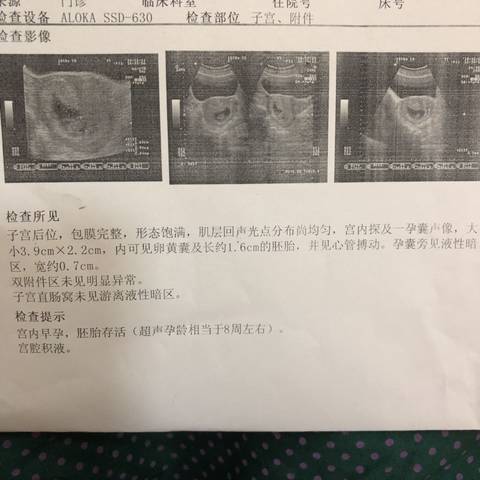 journal_insert_pic_1146935529
