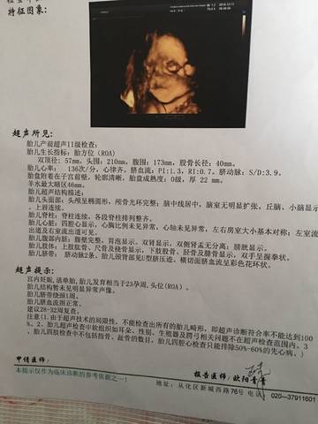 journal_insert_pic_1146710737