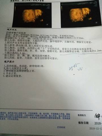 journal_insert_pic_1147193767