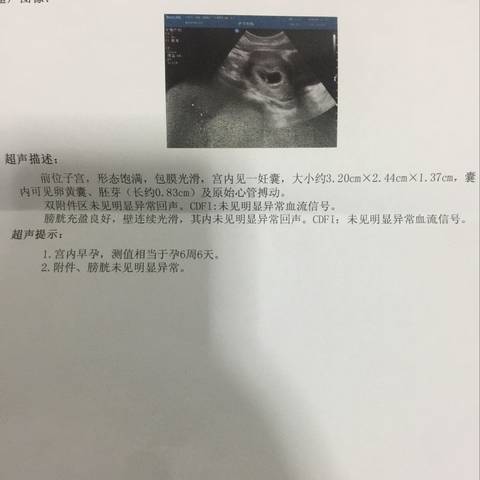 journal_insert_pic_1147238622