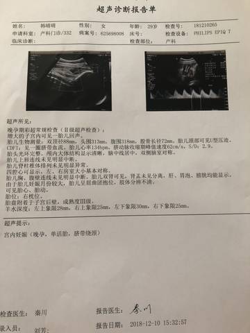 journal_insert_pic_1147068606