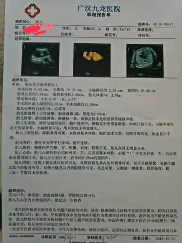 journal_insert_pic_1148013945