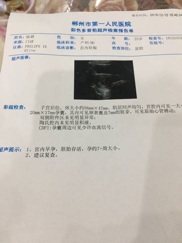 journal_insert_pic_1148727082
