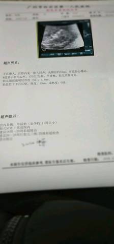 journal_insert_pic_1148578894